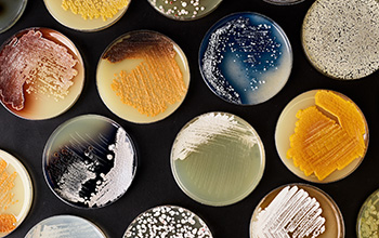 Petri dishes containing genus Streptomyces